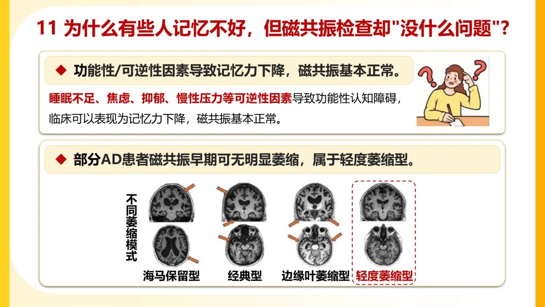 一图读懂阿尔茨海默病【2026】11.jpg